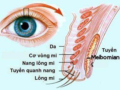 Chắp và lẹo mắt: nguyên nhân, triệu chứng và cách điều trị