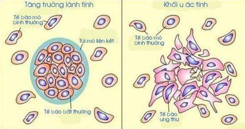 Tế bào già chết đi, tế bào non ra đời thay thế vị trí trong không gian và chức năng thì khối u không xuất hiện