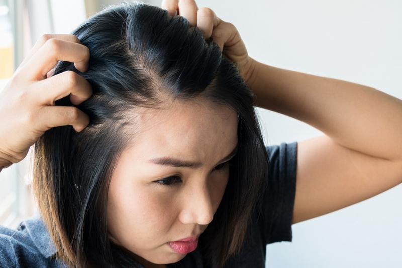 Uống hà thủ ô có đẹp da không? Những thông tin cần biết 1